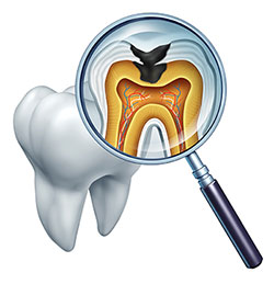 Davenport Dental Associates | Snoring Appliances, Root Canals and TMJ Disorders